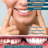 [COMPRÁ 1 Y LLEVÁ 2] - Smile Pro® - Carillas Dentales Removibles | Inferior y Superior